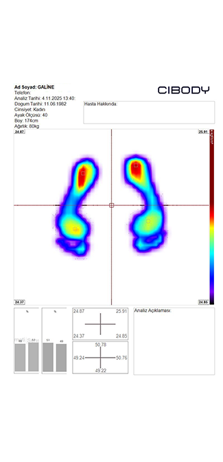 Foot Analysis